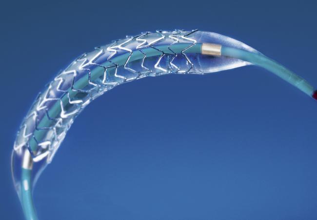 Global Nitinol Medical Devices Market Research Report 2017